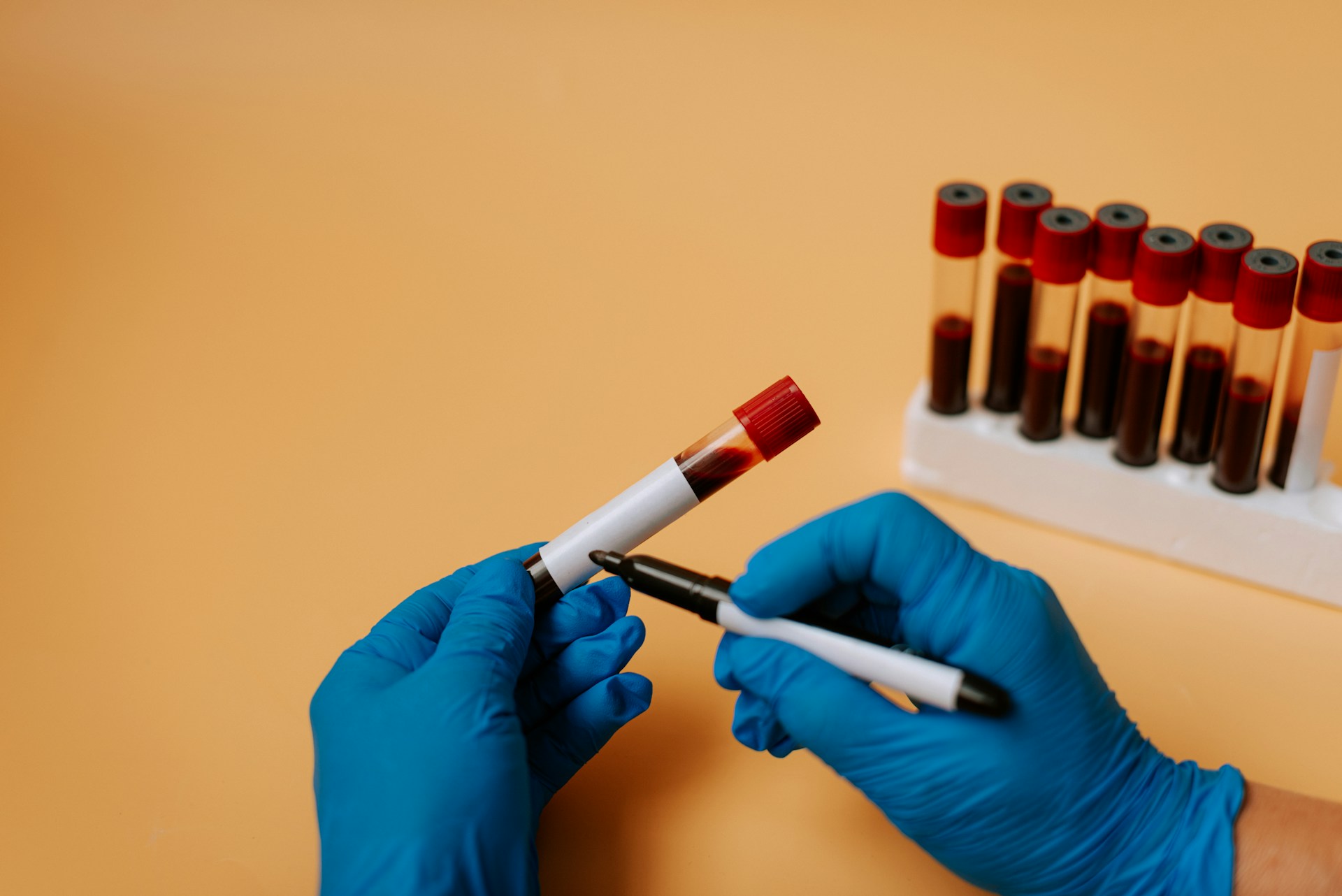 Phlebotomy Safety Essentials: PPE, Sharps Handling, and Exposure Prevention Best Practices